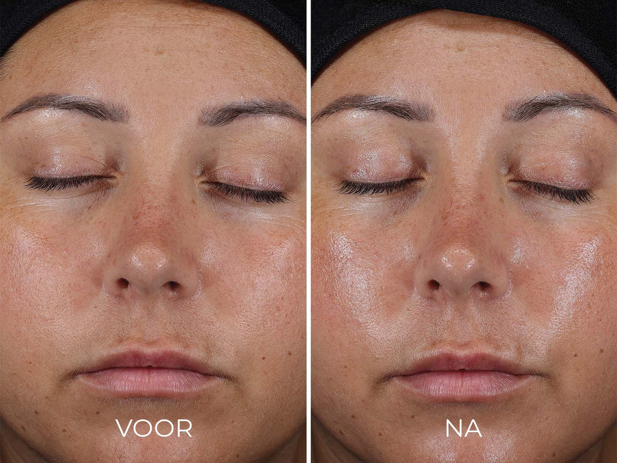 IMAGE Skincare DAILY PREVENTION - Ultra Defense Moisturizer SPF 50