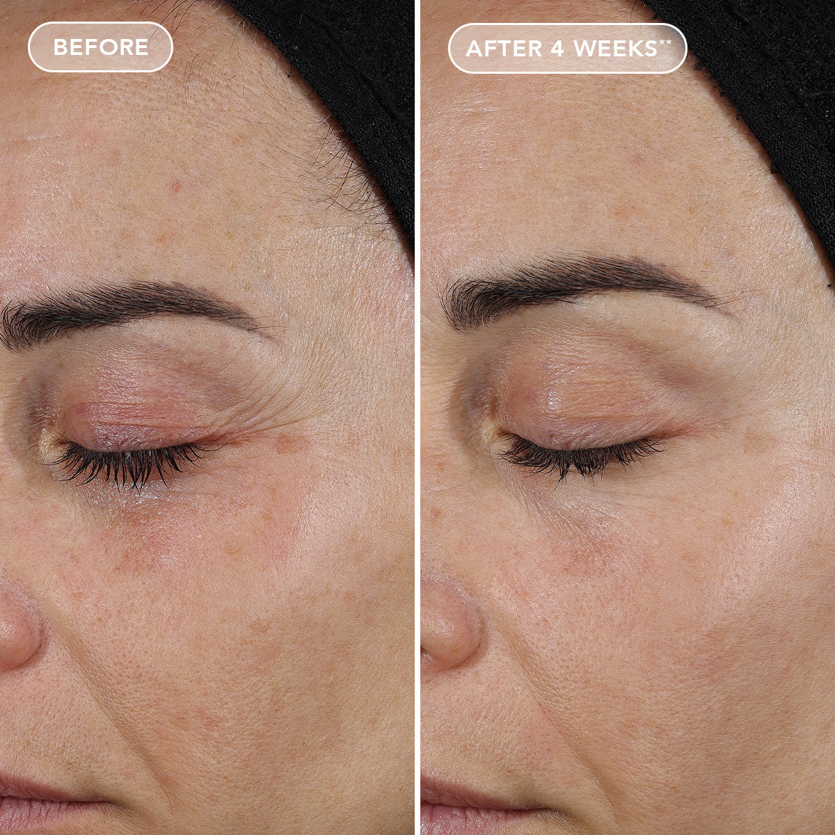 IMAGE Skincare AGELESS+ Retinol - Repair Crème 0.3% Retinol Complex