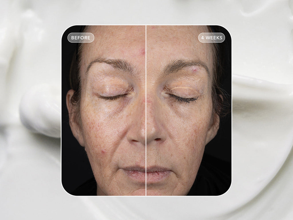 IMAGE Skincare VOL.U.LIFT - 4D Skin Rebound Complex