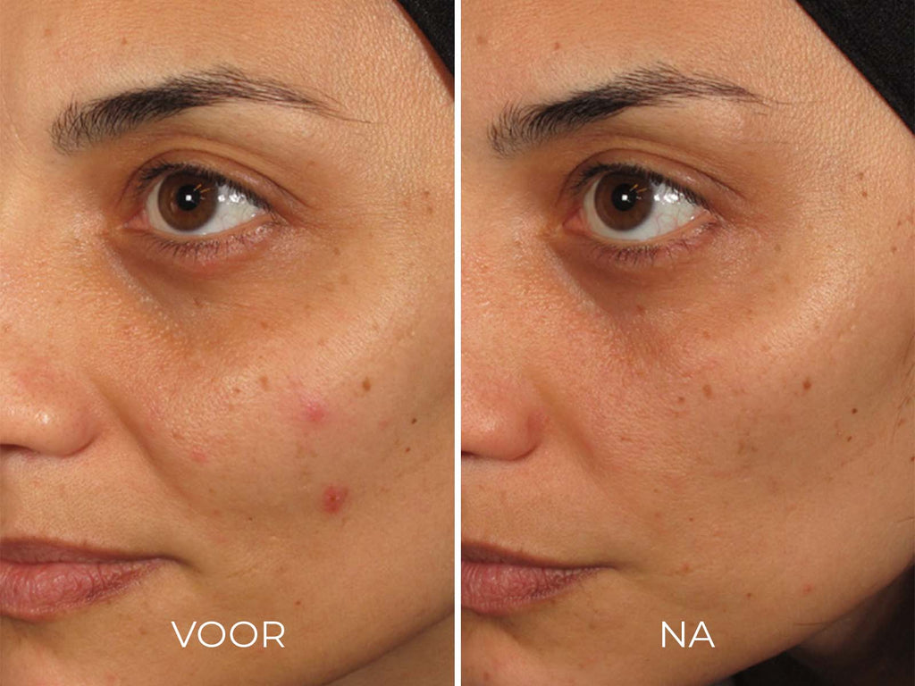 IMAGE Skincare ILUMA - Intense Facial Illuminator