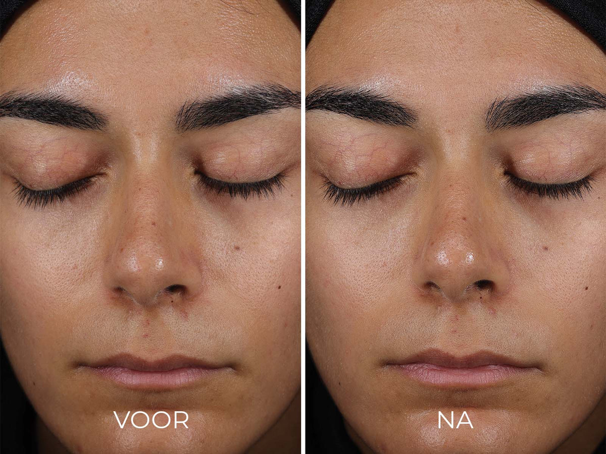 IMAGE Skincare DAILY PREVENTION - Sheer Matte Moisturizer SPF 30