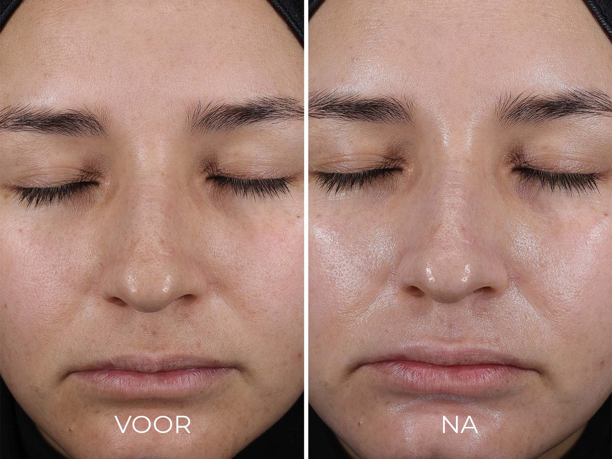 IMAGE Skincare DAILY PREVENTION - Pure Mineral Hydrating Moisturizer SPF 30